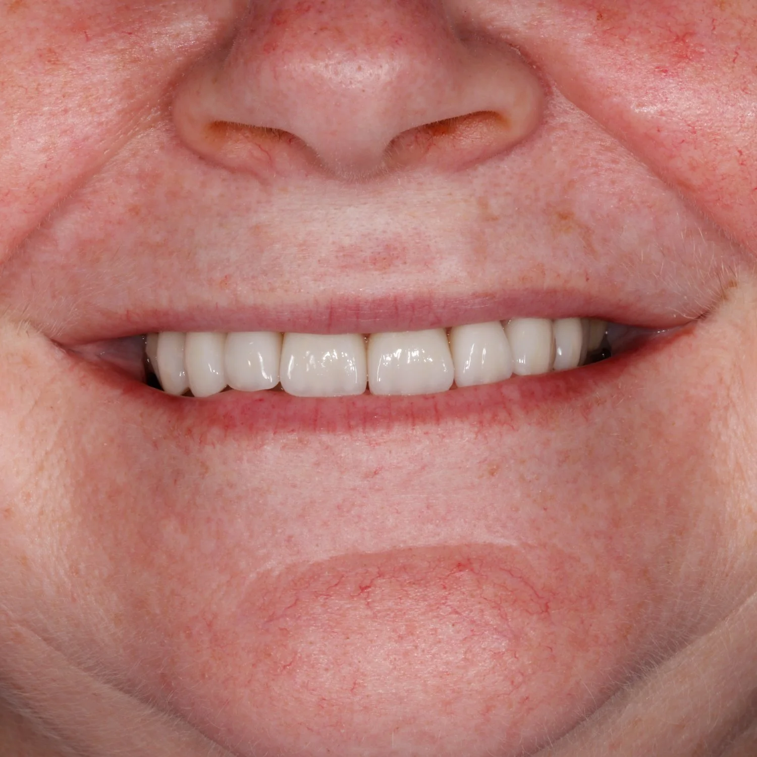 Emergency Dentist Sarnia