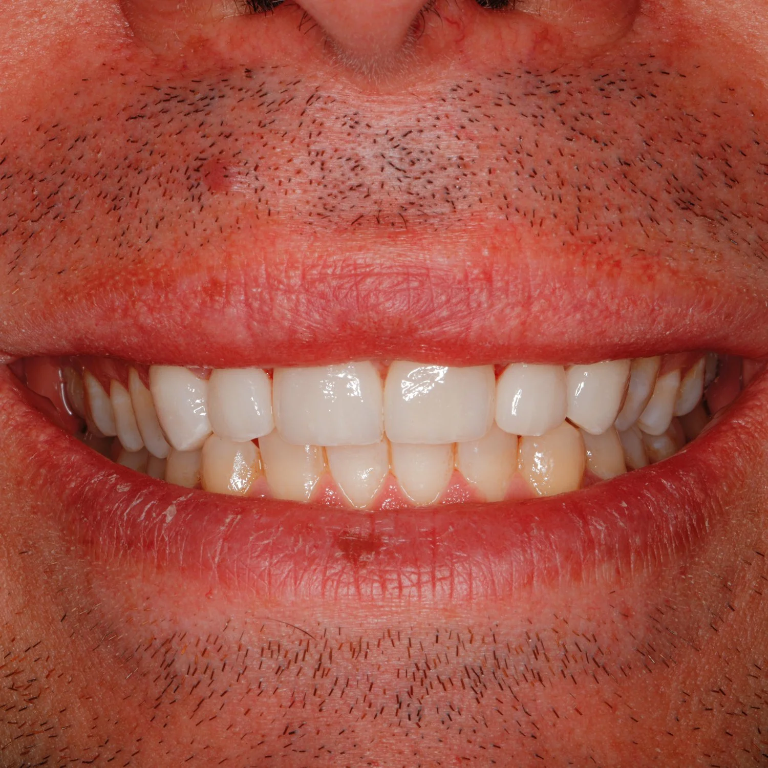 Emergency Dentist Sarnia
