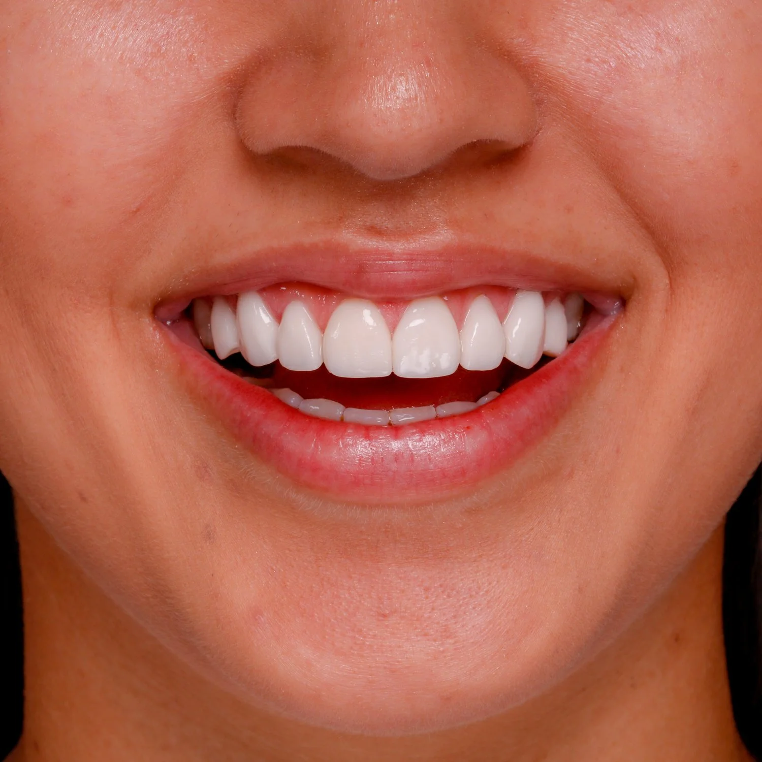 Family Dentist Sarnia