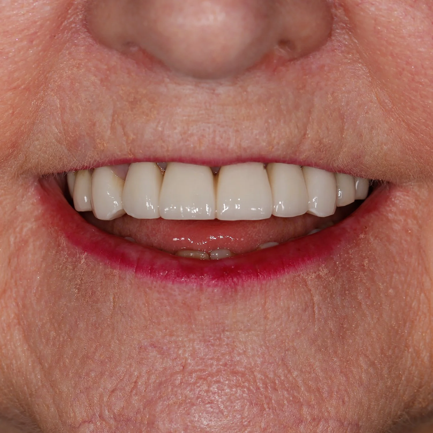 Emergency Dentist Sarnia